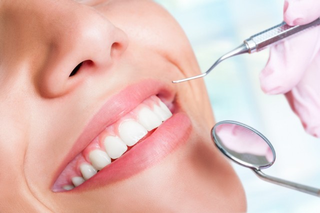 Dental 101: How It All Started with Dental Veneers